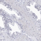 Immunohistochemical staining of human prostate shows no positivity in glandular cells as expected.
