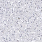 Immunohistochemical staining of human liver shows no positivity in hepatocytes as expected.
