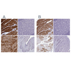 Anti-CASQ2 Antibody