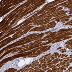 Immunohistochemical staining of human heart muscle shows strong cytoplasmic positivity in cardiomyocytes.