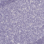 Anti-CASQ2 Antibody