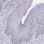 Immunohistochemical staining of human skin shows no positivity in squamous epithelial cells as expected.