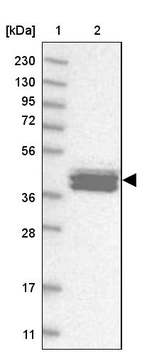 Lane 1: Marker [kDa] 230, 130, 95, 72, 56, 36, 28, 17, 11_br/_Lane 2: Human cell line RT-4