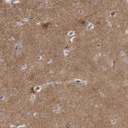 Anti-WDR47 Antibody