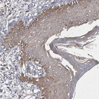 Immunohistochemical staining of human skin shows weak cytoplasmic positivity in squamous epithelial cells.