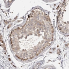 Immunohistochemical staining of human testis shows moderate cytoplasmic positivity in subset of cells in seminiferous ducts.