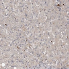 Immunohistochemical staining of human liver shows very weak positivity in hepatocytes as expected.