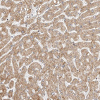 Immunohistochemical staining of human liver shows moderate cytoplasmic positivity in hepatocytes.