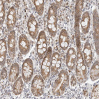Immunohistochemical staining of human duodenum shows moderate cytoplasmic positivity in glandular cells.