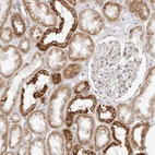 Immunohistochemical staining of human kidney shows moderate to strong cytoplasmic positivity in cells in tubules.