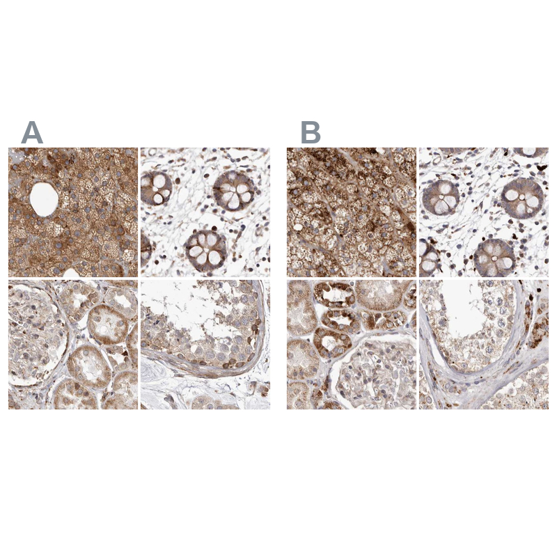 Anti-NUP43 Antibody