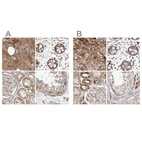 Anti-NUP43 Antibody