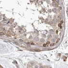 Immunohistochemical staining of human testis using Anti-NUP43 antibody HPA027291.