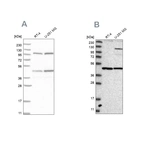 Western blot analysis using Anti-NUP43 antibody HPA027291 (A) shows similar pattern to independent antibody HPA027126 (B).