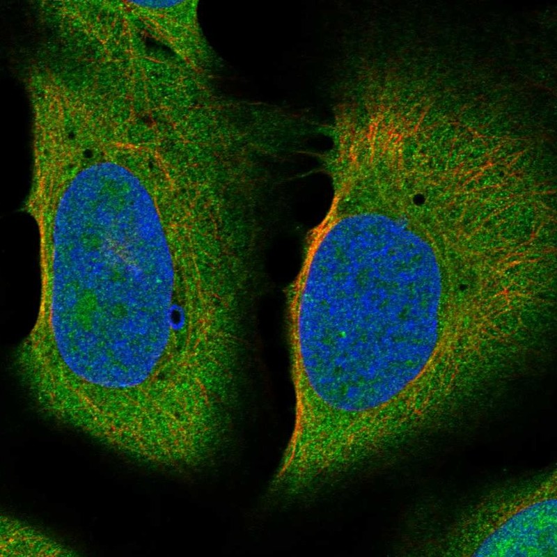 Anti-TEKT3 Antibody