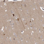 Immunohistochemical staining of human cerebral cortex shows moderate cytoplasmic positivity in glial cells.