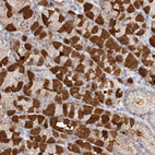 Immunohistochemical staining of human stomach shows strong cytoplasmic positivity in parietal cells.