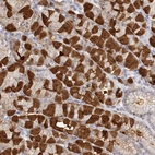 Immunohistochemical staining of human stomach shows strong cytoplasmic positivity in parietal cells.