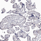 Immunohistochemical staining of human placenta shows no cytoplasmic positivity in trophoblastic cells as expected.
