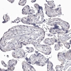 Immunohistochemical staining of human placenta shows no cytoplasmic positivity in trophoblastic cells as expected.