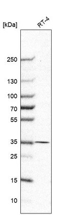 Western blot analysis in human cell line RT-4.