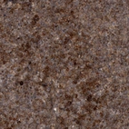 Anti-RAB3GAP2 Antibody