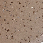 Immunohistochemical staining of human cerebral cortex shows strong cytoplasmic positivity in neurons.