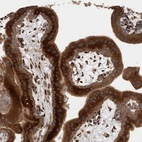 Immunohistochemical staining of human placenta shows strong cytoplasmic positivity in trophoblastic cells.