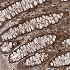 Immunohistochemical staining of human rectum shows strong cytoplasmic positivity in glandular cells.