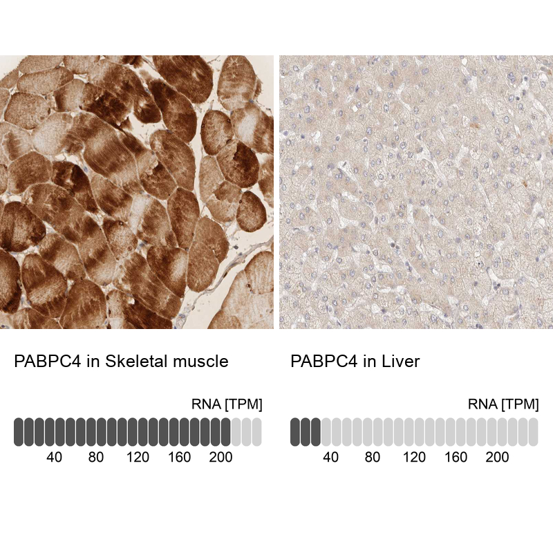Anti-PABPC4 Antibody