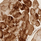 Immunohistochemical staining of human skeletal muscle shows strong cytoplasmic positivity in myocytes.