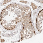 Immunohistochemical staining of human testis shows strong cytoplasmic positivity in spermatogonia.