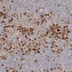 Immunohistochemical staining of human tonsil shows moderate cytoplasmic positivity in germinal center cells.