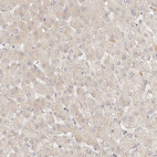 Immunohistochemical staining of human liver shows weak cytoplasmic positivity in hepatocytes.