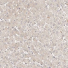 Immunohistochemical staining of human liver shows weak cytoplasmic positivity in hepatocytes.