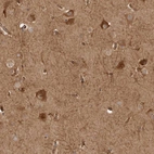 Immunohistochemical staining of human cerebral cortex shows strong cytoplasmic positivity in neurons.