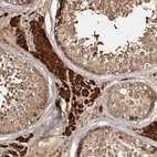 Immunohistochemical staining of human testis shows strong cytoplasmic positivity in Leydig cells.