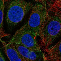 Anti-DLGAP3 Antibody