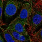 Anti-DLGAP3 Antibody