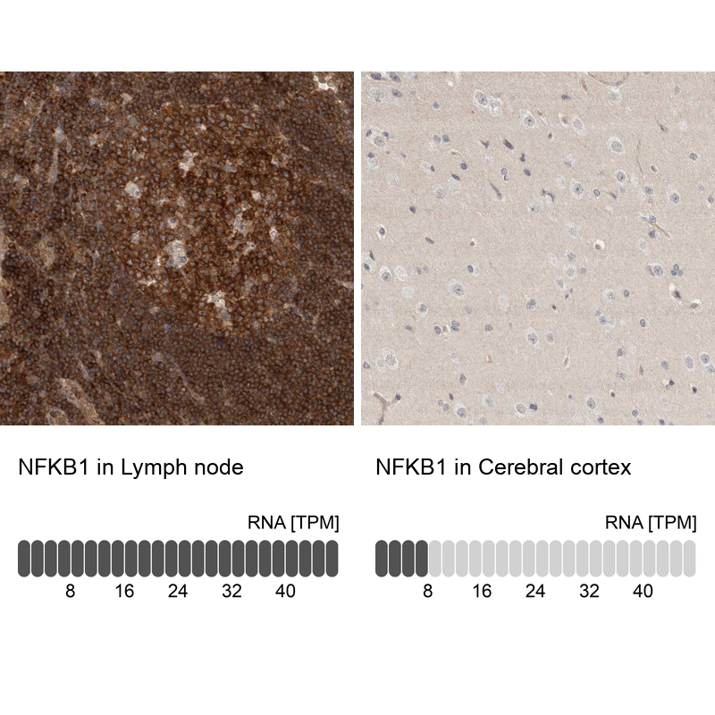Anti-NFKB1 Antibody
