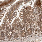 Immunohistochemical staining of human colon shows moderate cytoplasmic positivity in glandular and lymphoid cells.