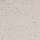 Immunohistochemical staining of human cerebral cortex shows no positivity in neurons as expected.
