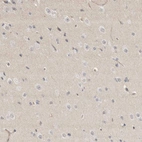 Immunohistochemical staining of human cerebral cortex shows no positivity in neurons as expected.