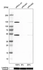 Western blot analysis in SK-BR-3 cells transfected with control siRNA, target specific siRNA probe #1 and #2, using Anti-NFKB1 antibody. Remaining relative intensity is presented. Loading control: Anti-GAPDH.