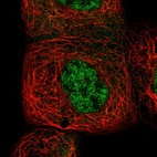 Immunofluorescent staining of human cell line A-431 shows localization to nucleoplasm & cytosol.