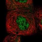Immunofluorescent staining of human cell line A-431 shows localization to nucleoplasm & cytosol.