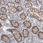 Anti-ZNF277 Antibody