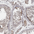 Immunohistochemical staining of human testis shows strong nuclear positivity in spermatogonia.