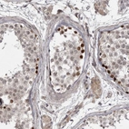 Immunohistochemical staining of human testis shows strong nuclear positivity in spermatogonia.