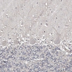 Immunohistochemical staining of human cerebellum shows no positivity in Purkinje cells as expected.